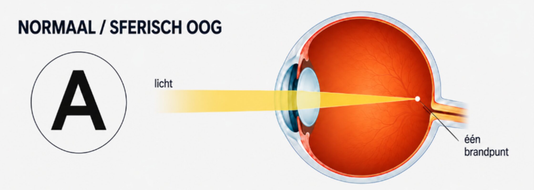 Oog 1